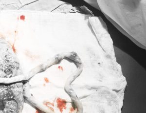 Foto. Moderkaka och navelsträng formad som ett hjärta på en handduk. Fotot är svartvitt förutom ett par bloddroppar på handduken.